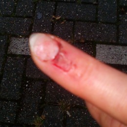 Ich schätze mal, 1Woche Pause.